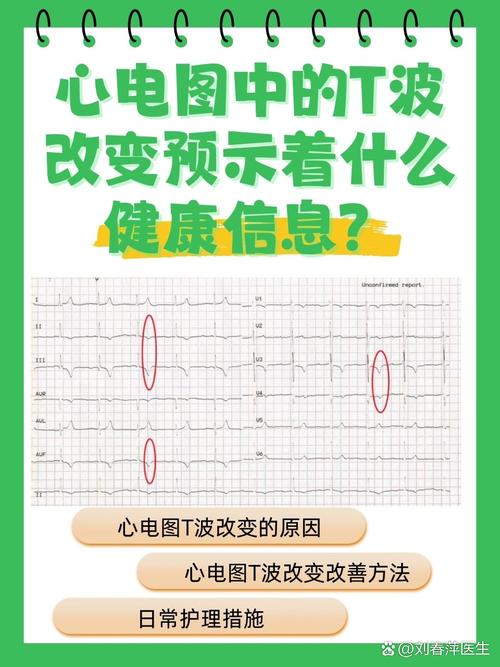 心电图中的T波改变预示着什么健康信息？
